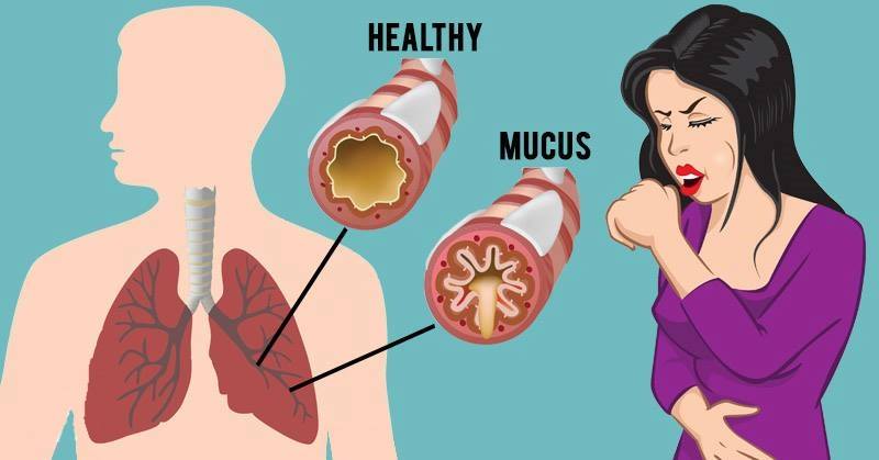 How To Get Rid of Mucus And Phlegm in Your Chest And Throat As Fast As ...