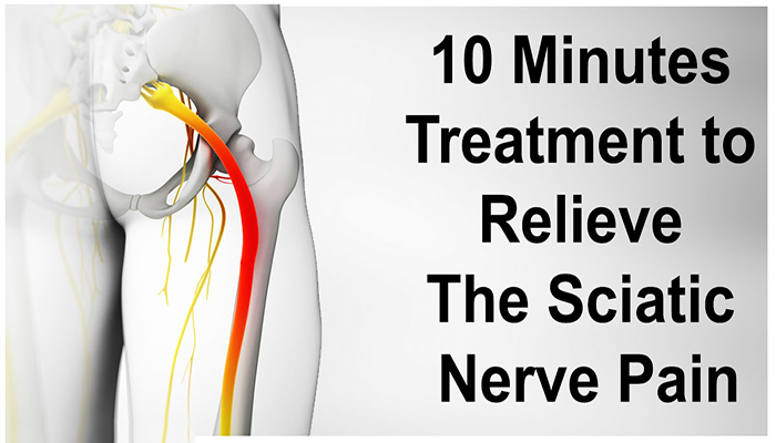 Severe Sciatic Nerve Pain Treatment